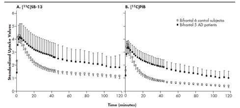 [11C]SB-13 and [11C]PIB show increased cortical retention in AD patients versus comparison subjects.