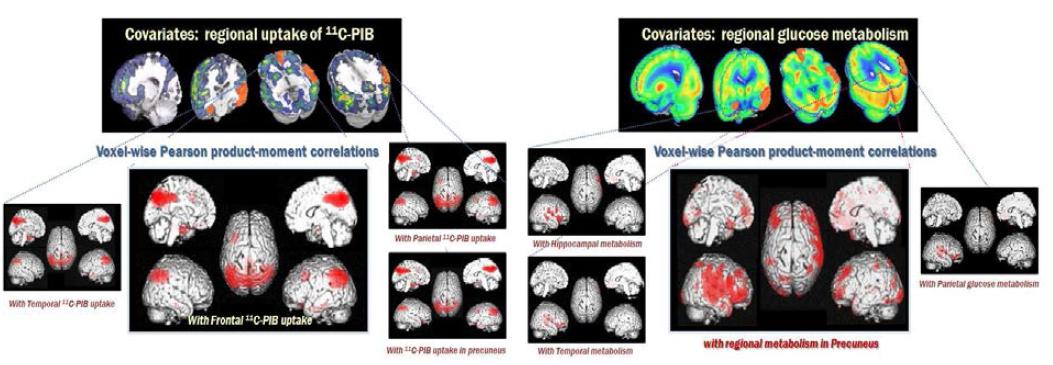 Inter-regional correlative relationship between amyloid deposit and glucose metabolism