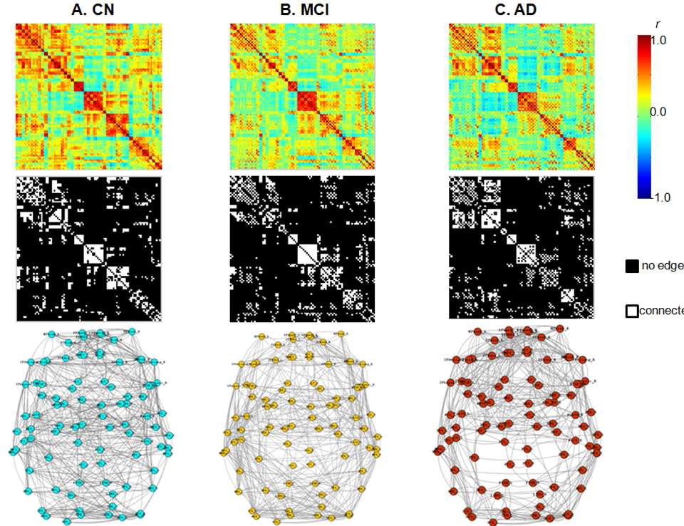 (A) 인지적 정상노인, (B) 경도인지장애 환자, (C) 알츠하이머병 환자의 뇌 기능적 네트워크