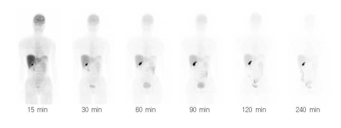 [18F]SNUBH-NM-333 전신 PET 영상으로부터 얻은 장기별 흡수선량 및 유효선량 영상