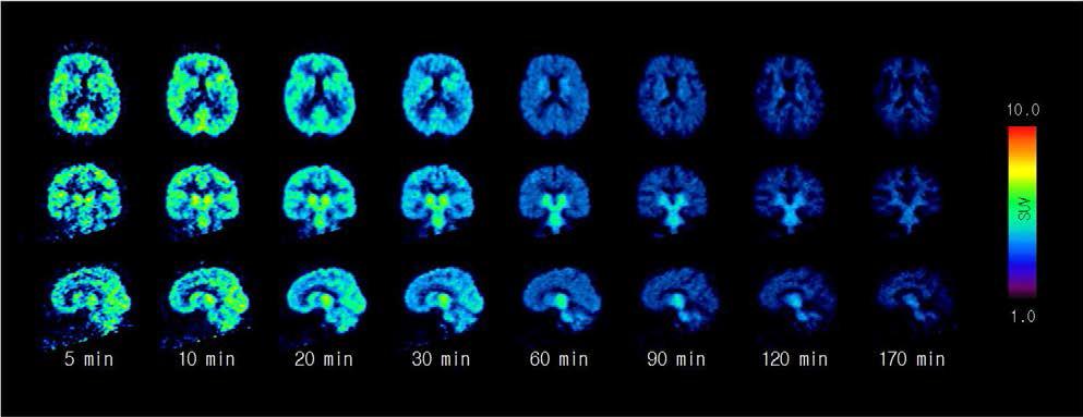 정상 청년의 [18F]SNUBH-NM-333 뇌 PET 영상