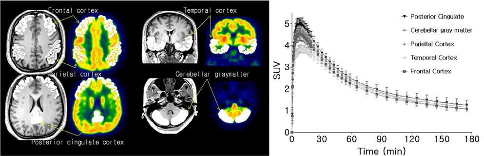 뇌 자기공명영상을 이용해 정의한 관심영역과 [18F]SNUBH-NM-333 뇌 PET 영상으로부터 구한 관심영역의 시간-방사능농도곡선