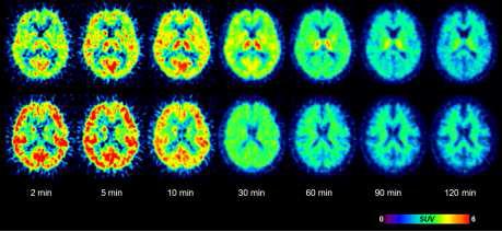 brain regional time-course of SNUBH-NM-333(upper) vs SNUBH-NM-371(bottom) in human