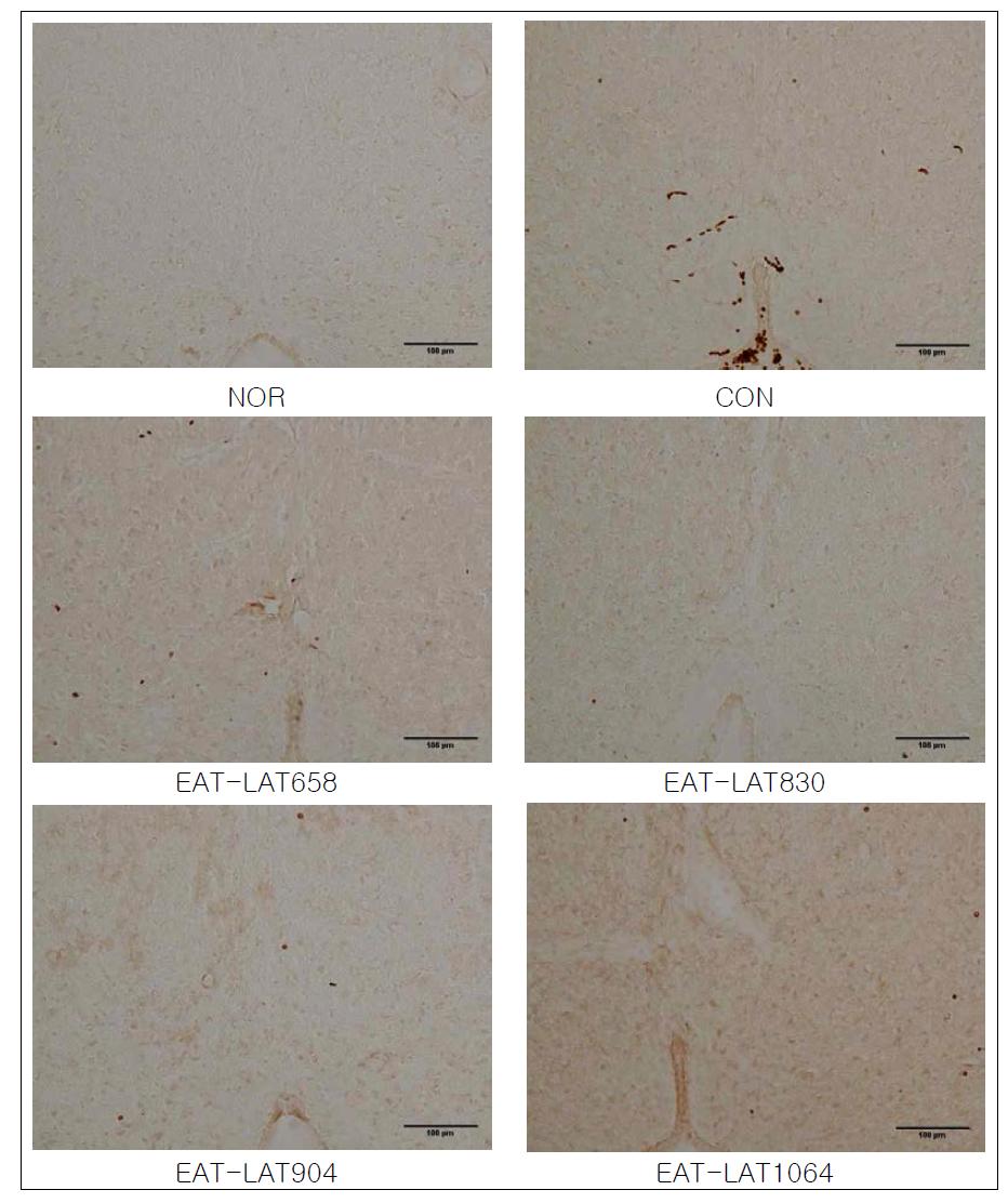 Effects of Electro-acupuncture and laser acupuncture at acupoint GB34․GB39 on the c-Fos activity in the central gran of brain of neuropathic pain rats induced by tibial and sural nerve transection