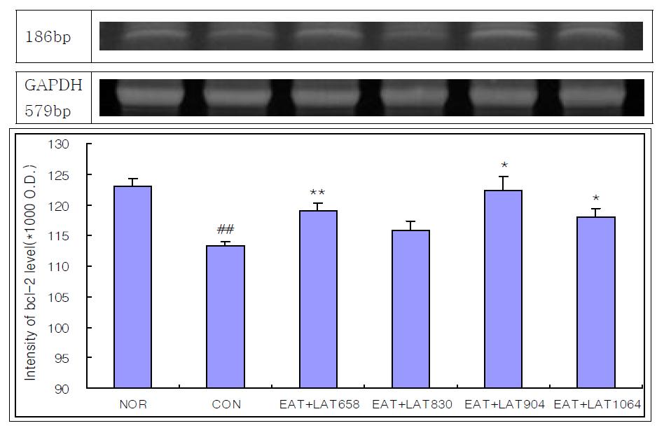 Effects of Electro-acupuncture and laser acupuncture at acupoint GB34․GB39 on the activity of Bcl-2 in the central gran of brain of neuropathic pain rats induced by tibial and sural nerve transection