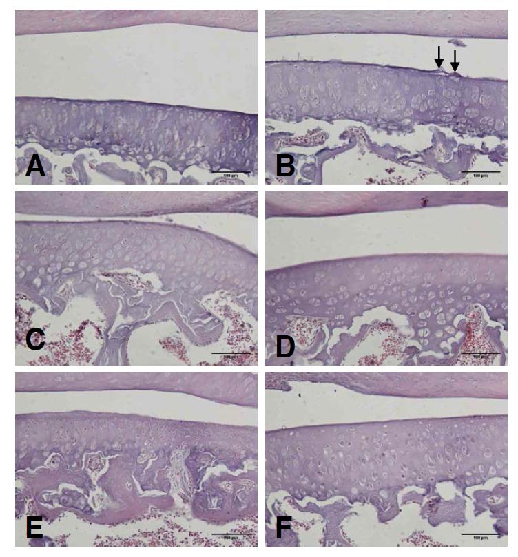 Changes on the histopathological change (HE stain) of knee joint after manual acupuncture and laser acupuncture at Gallbladder Seunggyeok acupoint in CFA induced arthritis rats