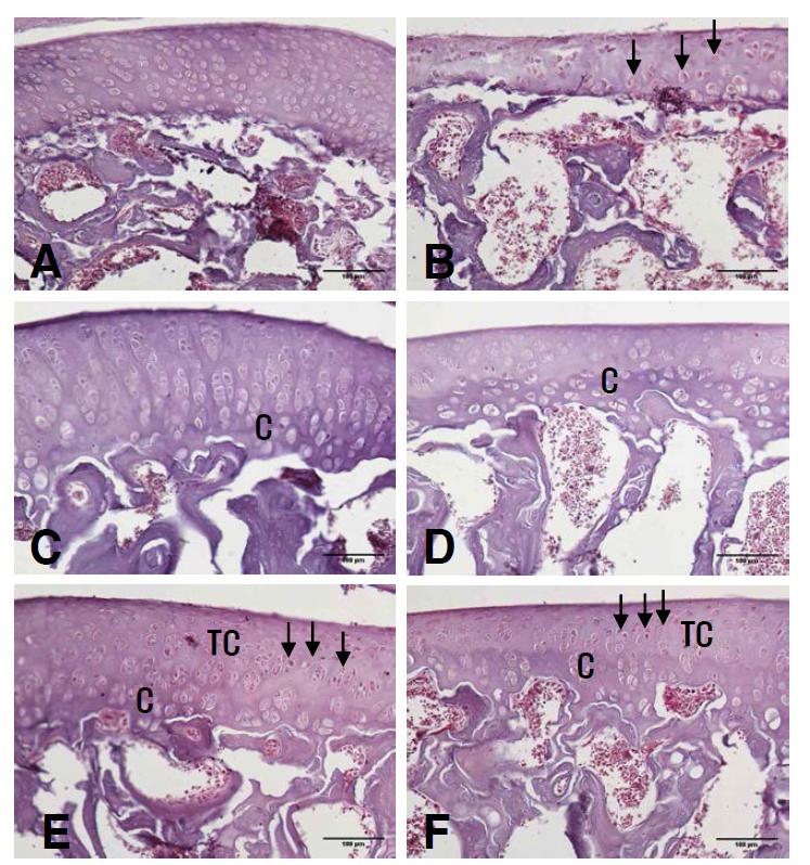 Changes on the histopathological change (Safranin O-fast stain) of knee joint after manual acupuncture and laser acupuncture at Gallbladder Seunggyeok acupoint in CFA induced arthritis rats