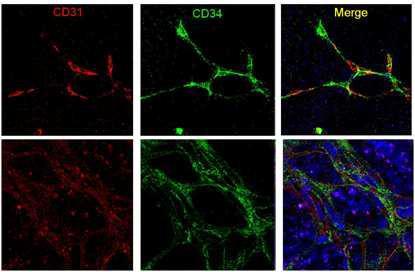 인간배아줄기세포로부터 분화된 CD34+/CD31+ 세포의 면역염색