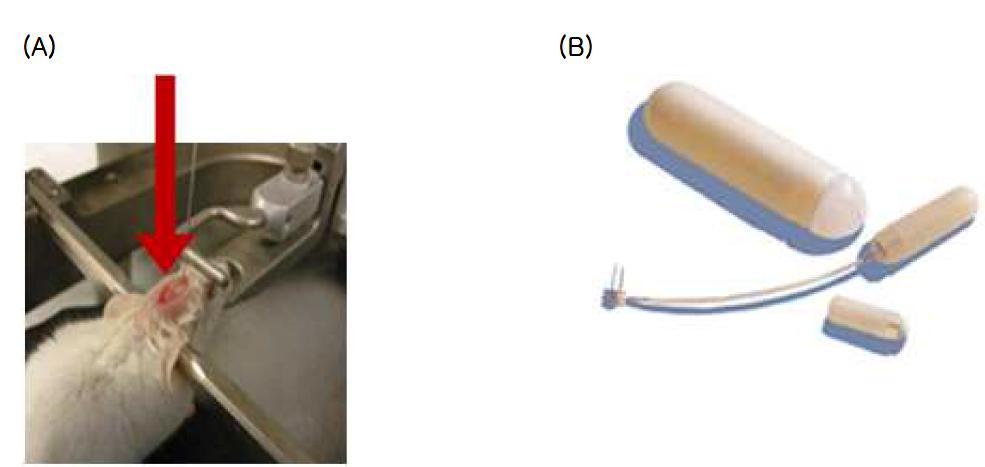 아밀로이드 베타 1-42의 뇌내투여 (A), 뇌내투여의 장기간 투여를 위한 Alzet osmotic pump® (B)