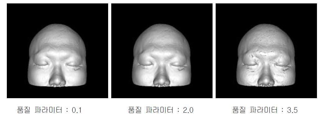 기존 해상도의 MR영상(Size : 512X512)을 이용한 3D 렌더링 (가우시안 필터 적용)