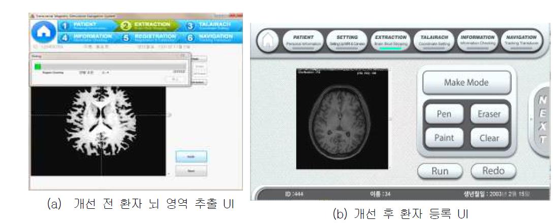 뇌 영역 추출 UI