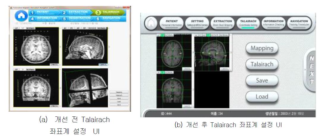 Talairach 좌표계 설정 UI