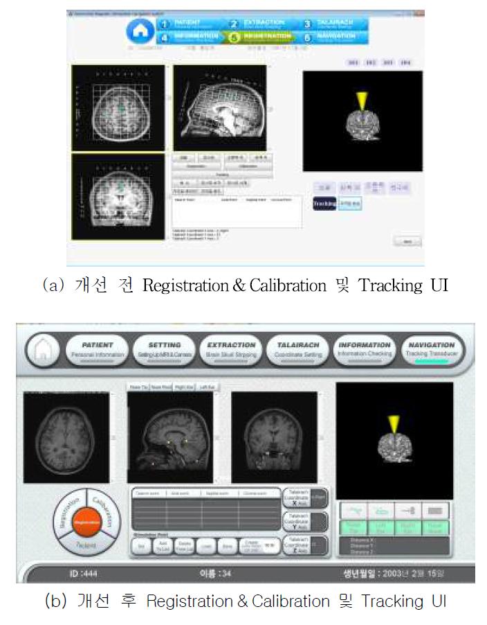 Tracking UI