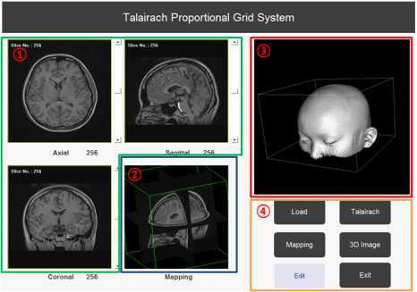 MRI 3D영상 소프트웨어 구현