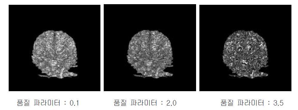 가우시안 필터 적용 전에 VTK 품질 파라미터 값 변화에 따른 3D 영상화 렌더링 결과