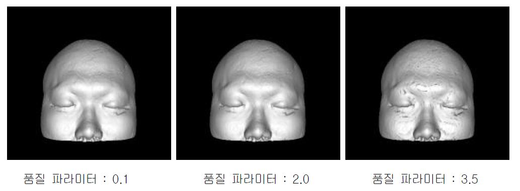 기존 해상도의 MR영상(Size : 512X512)을 이용한 3D 렌더링 (가우시안 필터 적용)