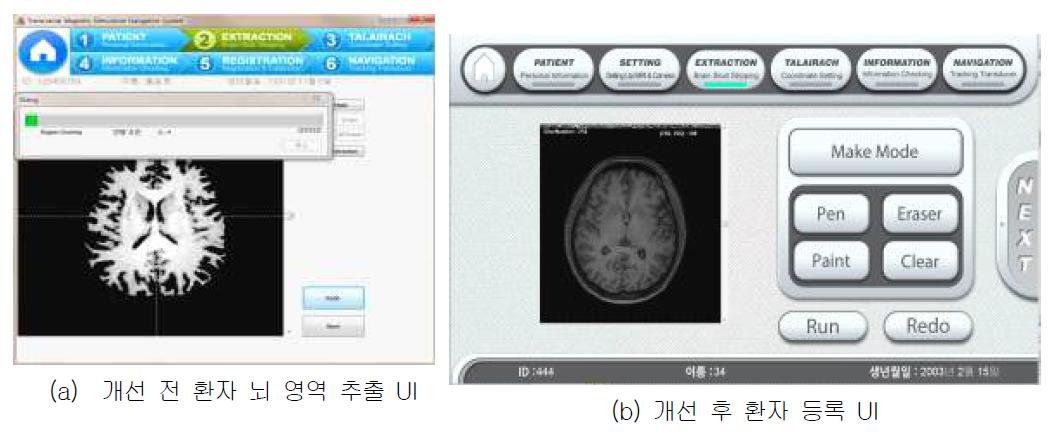 뇌 영역 추출 UI