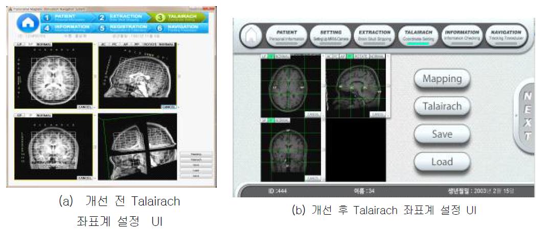 Talairach 좌표계 설정 UI