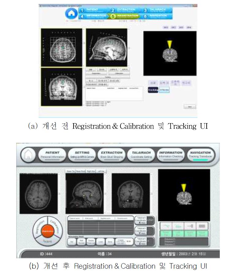 Tracking UI