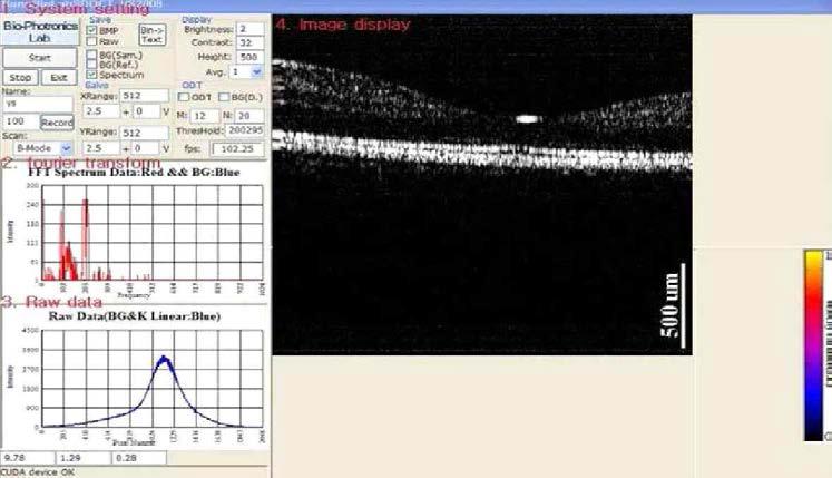 1단계에서 개발된 GUI 에서 실시간으로 구현되고 있는 망막 영상