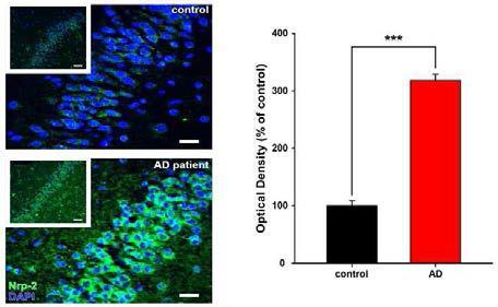 알츠하이머병 환자 뇌 해마부위의 neuropilin-2의 immunoreactivity 증가