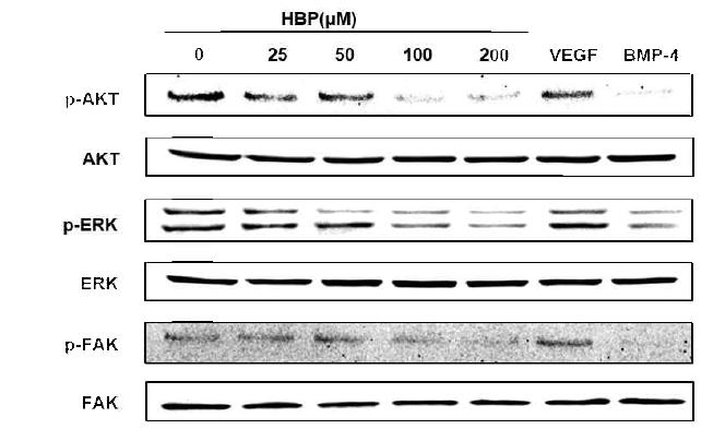 HBP를 처리한 TCM에 의한 cell migration 관련 protein level확인