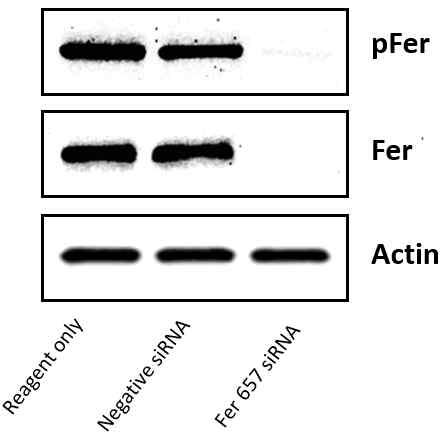 CD44high MDA-MB-231에서 siRNA에 의한 Fer 단백질의 발현억제