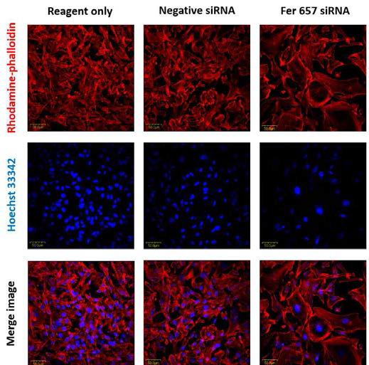 CD44high MDA-MB-231에서 Fer siRNA에 의한 Actin filament의 변화 확인