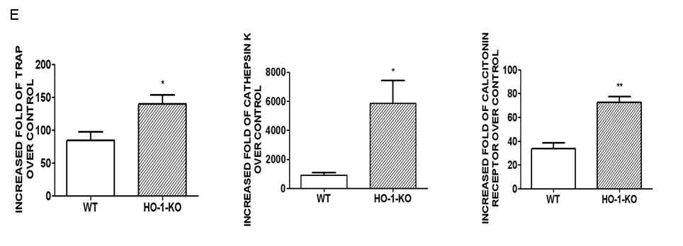 파골세포분화시 HO-1 부재는 TRAP, cathepsin K, calcitonin receptor의 mRNA를 현저히 증가시킴.