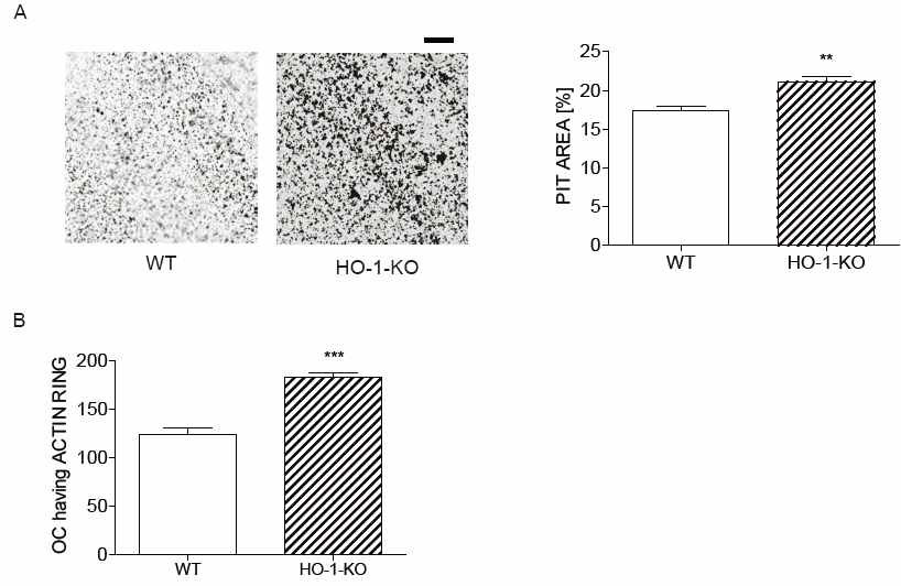 dentine slice 에 bone resorption assay시, HO-1부재는 pit 면적을 증가(A), actinring을 가진 파골세포의 수의 증가(B).