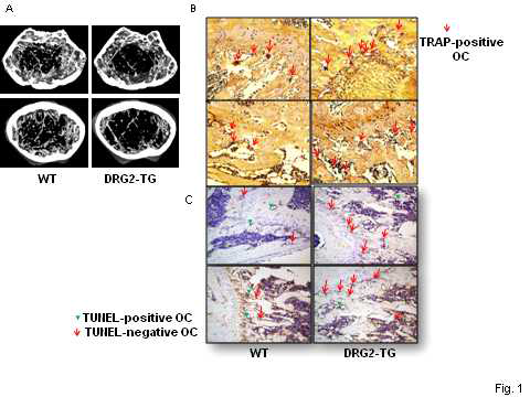 DRG2-TG쥐에서 in vivo bone remodeling에서 골소실 유발, in vivo TRAP staing에서 파골세포의 수 증가, TUNEL-positive 파골세포의 감소.