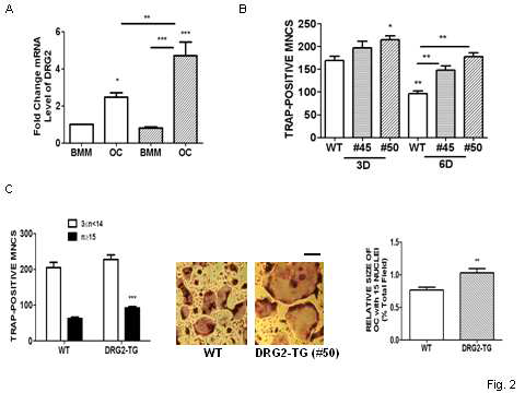 파골세포분화시 DRG2의 발현수준, DRG2 과발현시 TRAP-positive MNC, 핵이 15개 이상의 파골세포와 세포의 크기