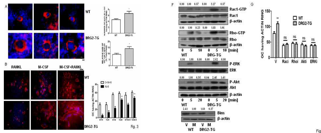 DRG2 과발현에 의한 in vivo 파골세포의 actin ring staining, in vitro 파골세포의 actin ring 형성의 증가, WT과 비교시 ERK, Akt, Rac1, Rho 인산화의 증가.