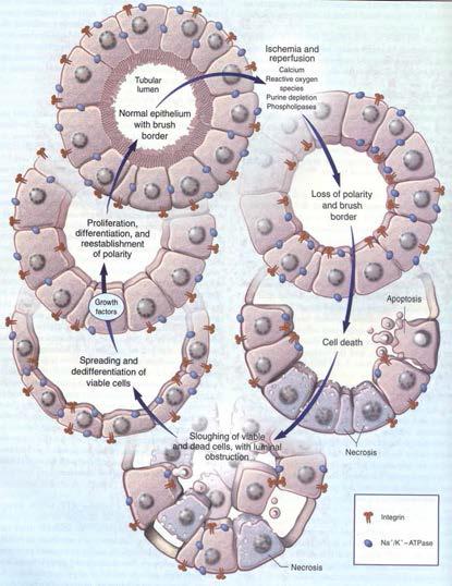 Scheme in the changes of tubular epithelial cells after acute kidney injury