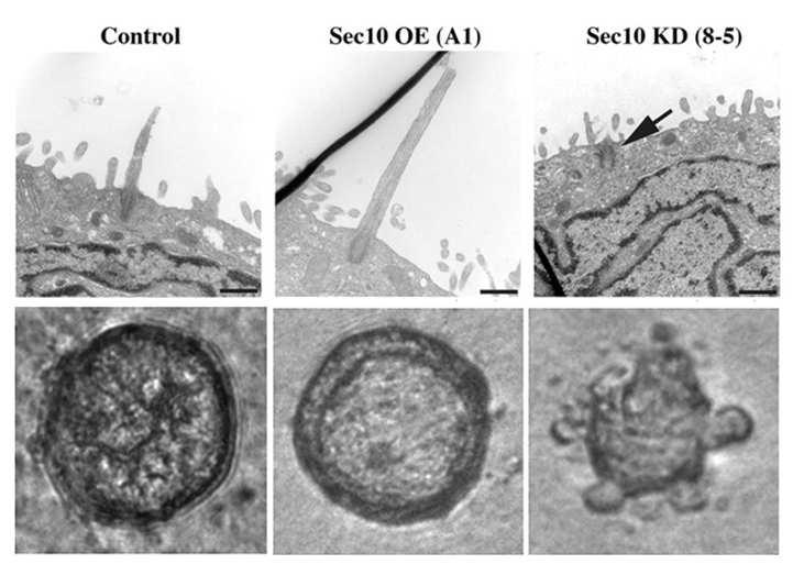 Acceleration of MDCK ciliogenesis and cystogenesis by Sec10 overexpression.