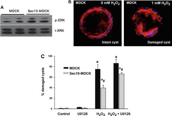 Sec10 overexpression attenuated the damage of cysts induced by hydrogen peroxide treatment