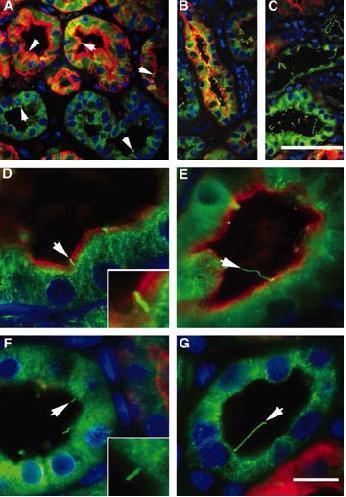 Primary cilia in biopsies from a renal allograft with transplantation-induced ATN