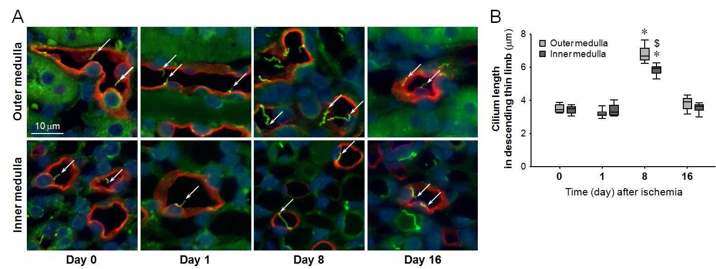 Cilia staining (A) and quantification of cilia length (B) in the kidneys after ischemia and reperfusion injury