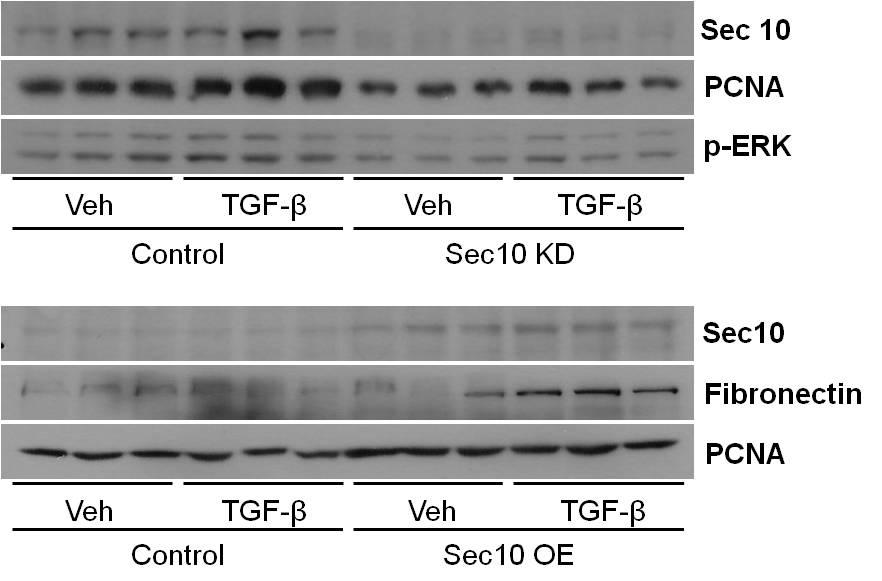 Effect of SEC10 overexpression and knockdown on sec10, fibronectin, ERK, and PCNA followed by TGF-b treatment