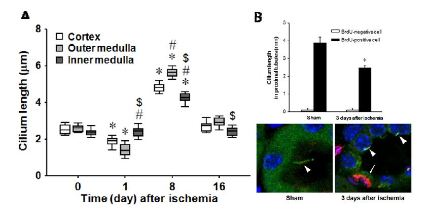 Alteration of primary cilia after ischemia and reperfusion injury