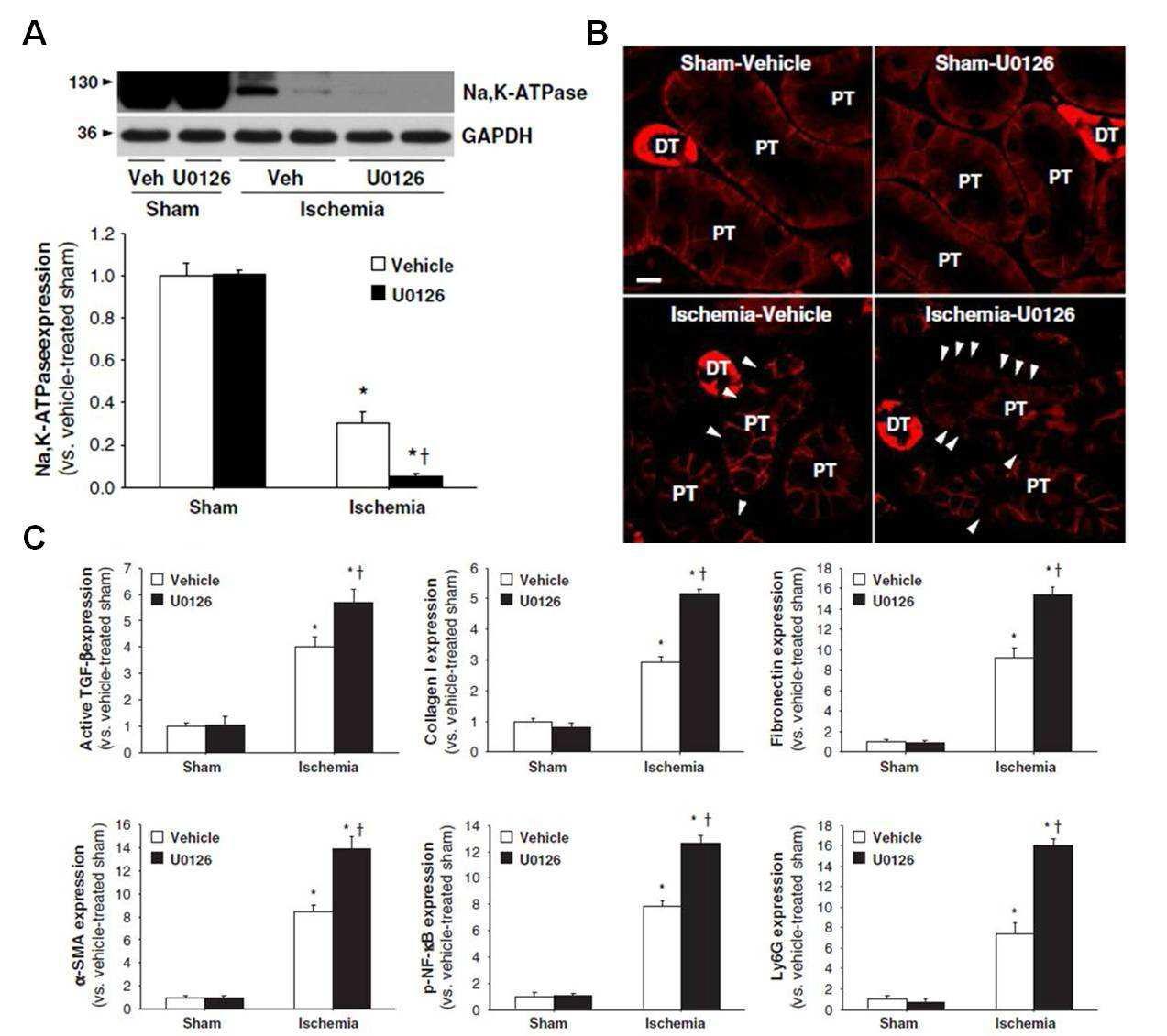 Effect of inhibition of ERK on Na,K-ATPase and fibrosis-related protein expression in ischemic kidneys. Mice were subjected to either 30 min of unilateral renal ischemia (Ischemia) or sham surgery (Sham).