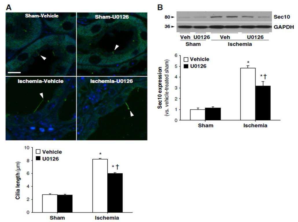 Effect of inhibition of ERK on primary cilia length and Sec10 expression in ischemic kidneys. Mice were subjected to either 30 min of unilateral renal ischemia (Ischemia) or sham surgery (Sham).