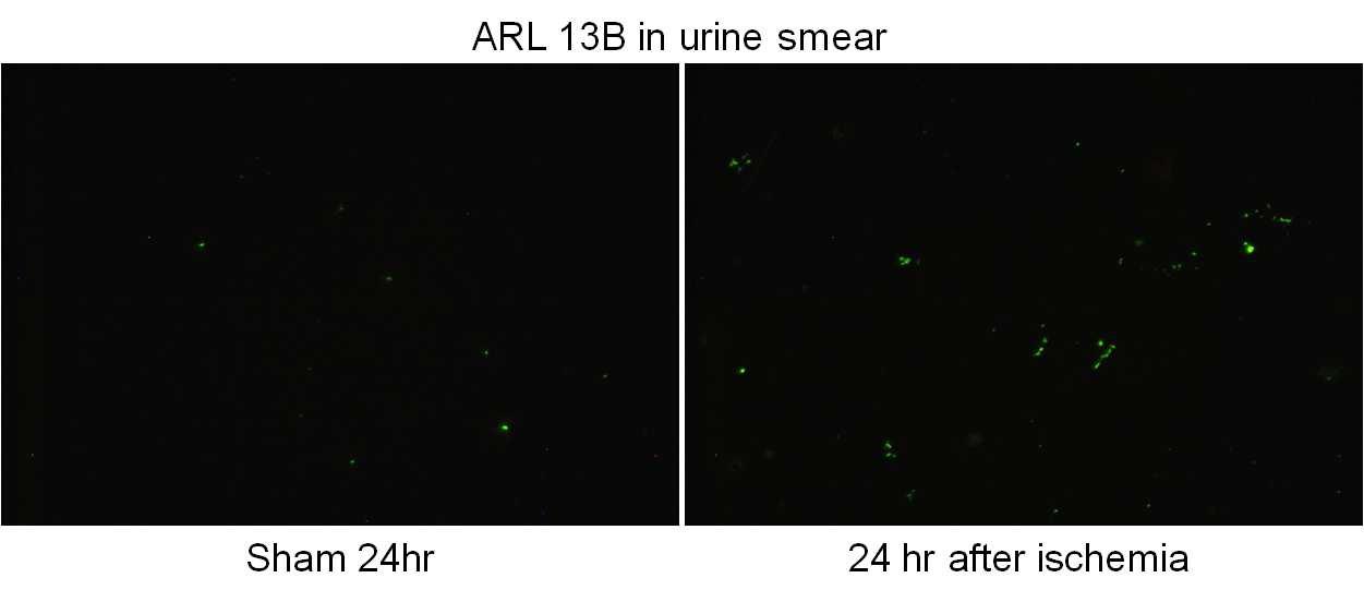 Detection of urinary cilia after I/R injury