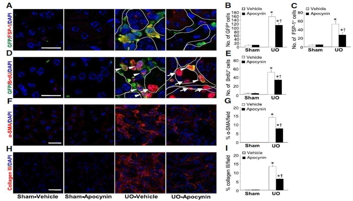 Inhibition of kidney fibrosis by administration of antioxidant, apocynin. BM-chimeric mice were subjected to either UO or sham, followed by harvest at 12 days after the operation