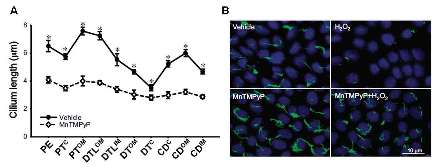 Effect of Mn(III) tetrakis(1-methyl-4-pyridyl) porphyrin (MnTMPyP) treatment on the alterations of primary cilia length