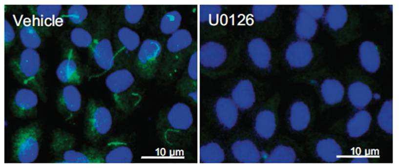 Effect of ERK activation in the elongation of primary cilium