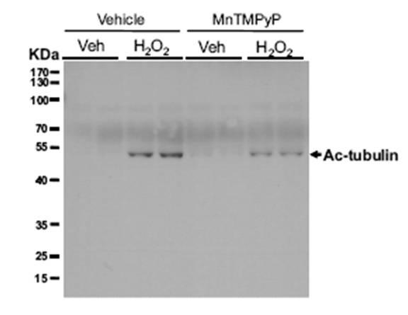 Effect of Mn(III) tetrakis(1-methyl-4-pyridyl) porphyrin (MnTMPyP) treatment on the deciliation