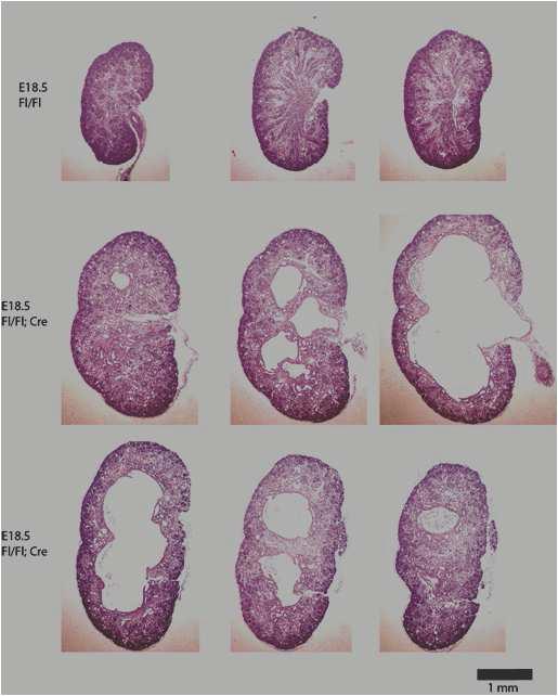 Development cyst of kidney of Sec10 gene deletion