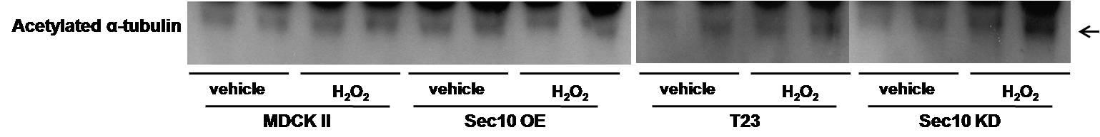 The role of Sec10 on deciliation in H2O2 treated kidney tubule cells