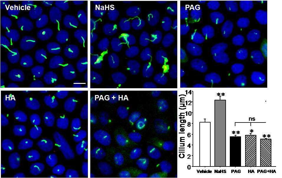 Hydrogen sulfide elongates primary cilia